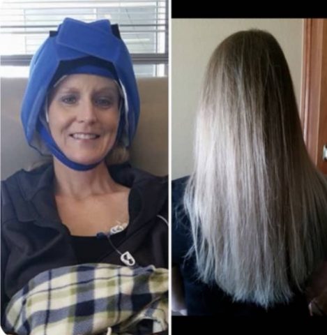 Cheryl during and after chemo