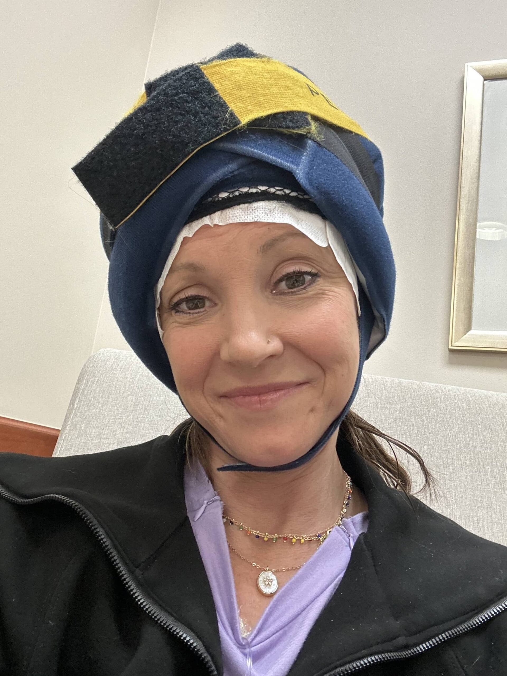 Erin wearing Penguin Cold Caps during chemotherapy treatment to help reduce hair loss