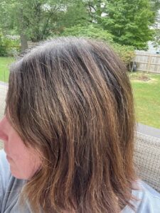 Heather's retained hair after four rounds of chemotherapy using Penguin Cold Caps